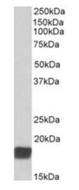 CIRBP (aa 161-172) Antibody
