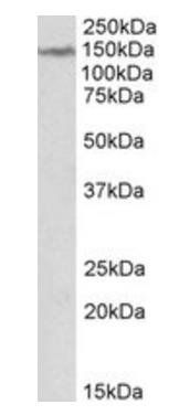 LMTK2 Antibody