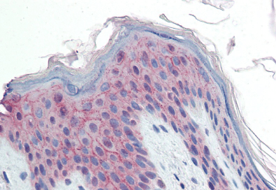 PPPDE1/PNAS4 Antibody