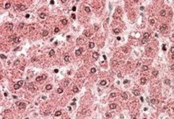 ALDH5A1 (aa 485-496) Antibody