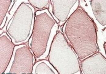 TRIM72 Antibody