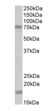TGM7 Antibody