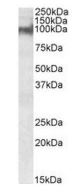 Plakophilin 2 (aa125-139) Antibody