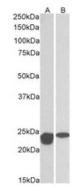 MNSOD (aa119-130) Antibody