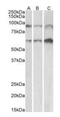 ADAM12 (aa225-239) Antibody
