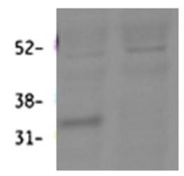 Hsd11b1 (mouse) Antibody