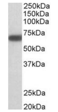 GAD25/GAD67 Antibody