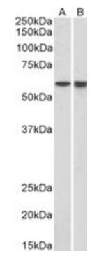 LCK (aa39-52) Antibody
