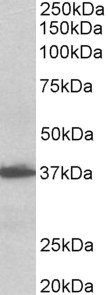 AIMP1/SCYE1 (aa137-149), Biotinylated Antibody