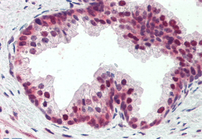 PDCD4 (aa210-221) Antibody