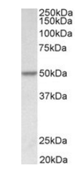 PDCD4 (aa210-221) Antibody