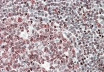 Fubp1 (mouse, aa160-174) Antibody