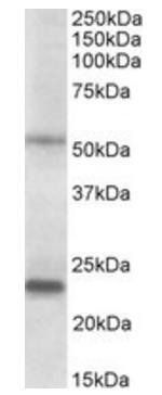 MMP3 (aa459-473) Antibody