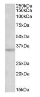 TSPAN5/NET-4 Antibody