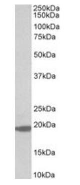 MCTS1 Antibody
