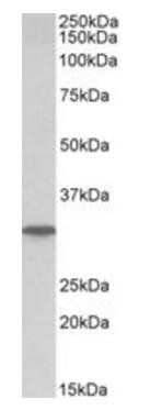 PNP (aa142-153) Antibody