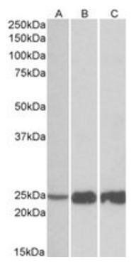 TNNI2 Antibody