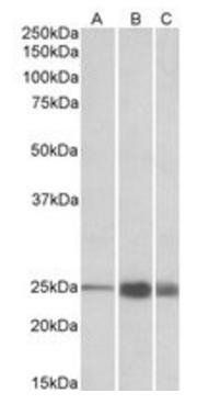 TNNI2 (aa83-95) Antibody