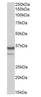 HNRNPA2B1 Antibody