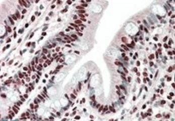 HNRNPA2B1 Antibody