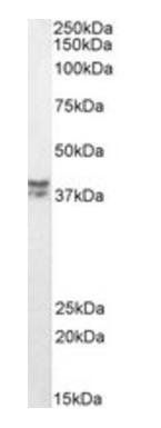 MSI2/musashi-2 (aa33-43) Antibody