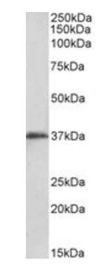 MSI2/musashi-2 (aa33-43) Antibody