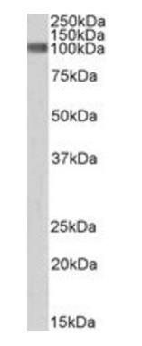 CTNNB1/catenin beta-1 (aa108-121) Antibody