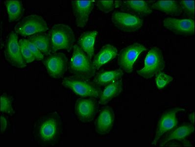 ECSCR Antibody