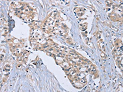 EDA Antibody
