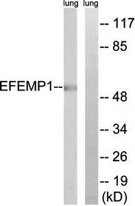 EFEMP1 Antibody