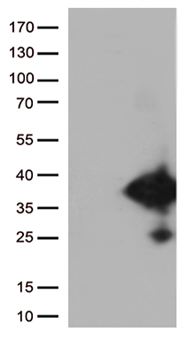 EFHD1 Antibody