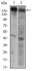 EGFR