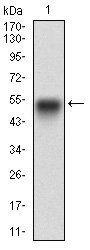 EGFR