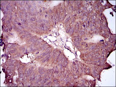 EGFR mutant