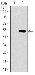 EGFR mutant