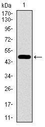 EGFR mutant