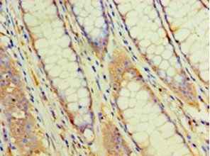 EHHADH Antibody