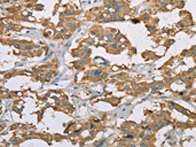 EHHADH Antibody