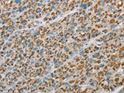 EHHADH Antibody