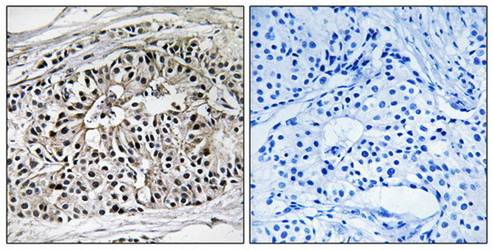 EHHADH Antibody