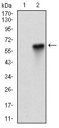 EIF2AK2