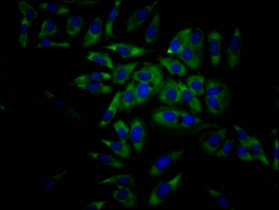 EIF4A1 Recombinant Monoclonal Antibody