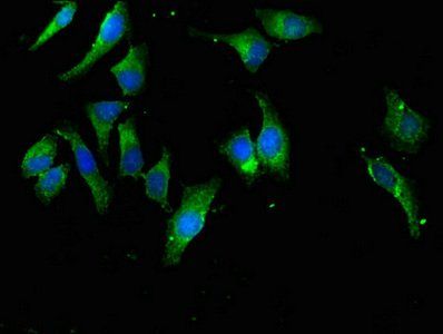 EIF4B Antibody
