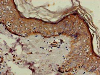 EIF4B Antibody