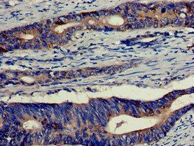 EIF4B Antibody