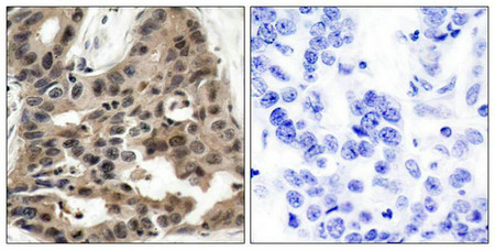 EIF4EBP1 (Ab-36) Antibody