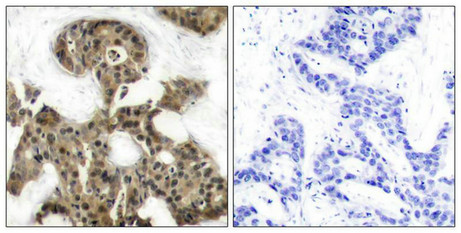 EIF4EBP1 (Ab-45) Antibody