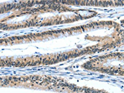 EIF4EBP1 Antibody