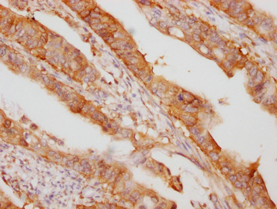 EIF5A Recombinant Monoclonal Antibody