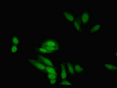 EIF5A2 Antibody